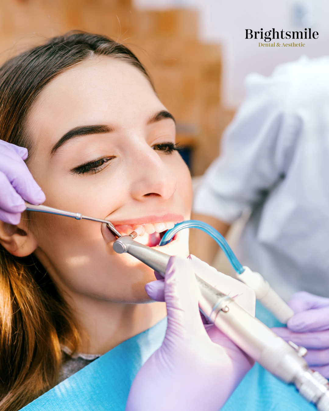 INSTAGRAM POST BRIGHTSMILE 21