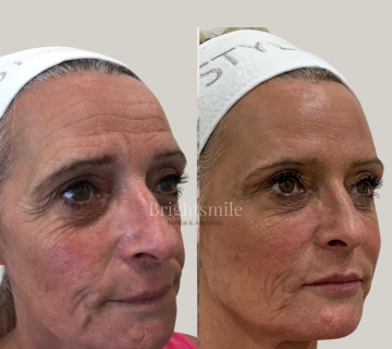 JAY JOSHI HYGIENIST 1 360x320