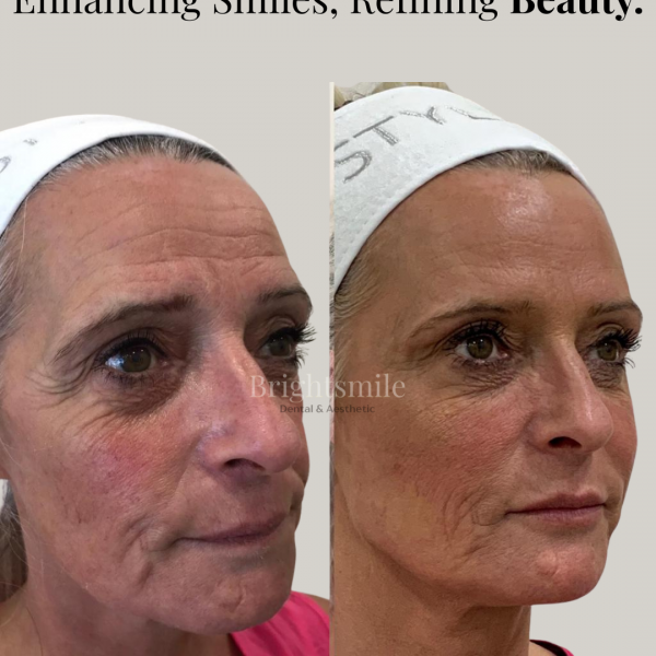 JAY JOSHI HYGIENIST (1)