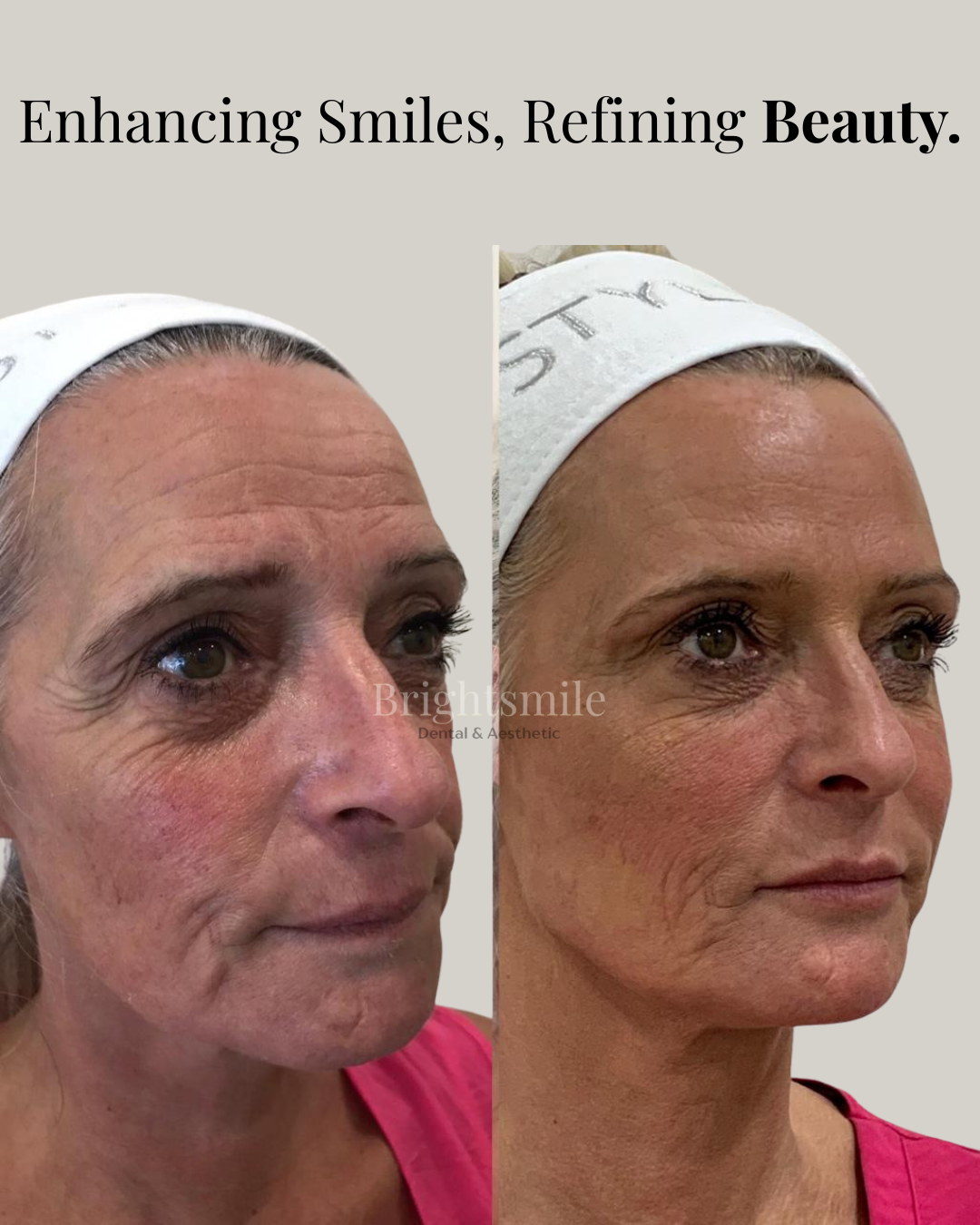 JAY JOSHI HYGIENIST 1