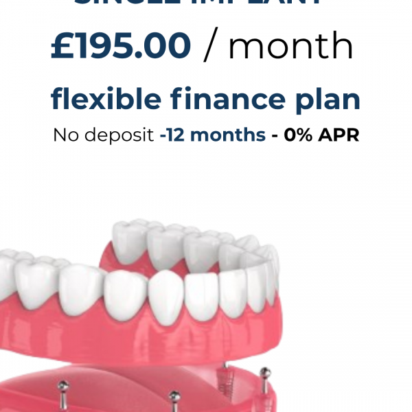 ALL -ON-4 FIXED TEETH