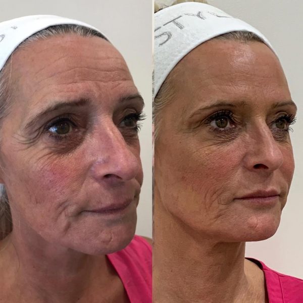 f61d893c-bedf-4ceb-a60a-9b6f20dd0ef7 (2)